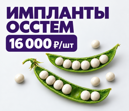 Имплант Осстем