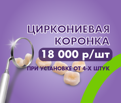 Коронки 4 шт за 17 000 р / шт