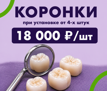 Коронки 4 шт - 18 000 р