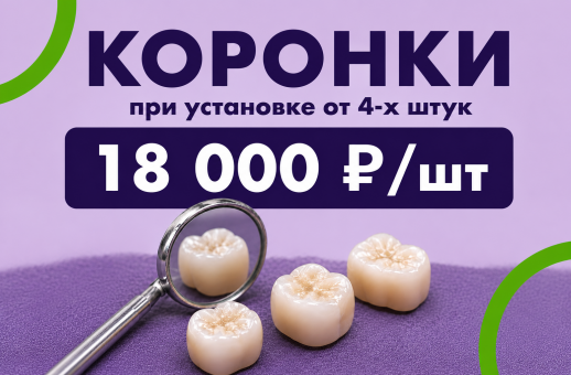 Коронки от 4-х по 18 000 р/шт